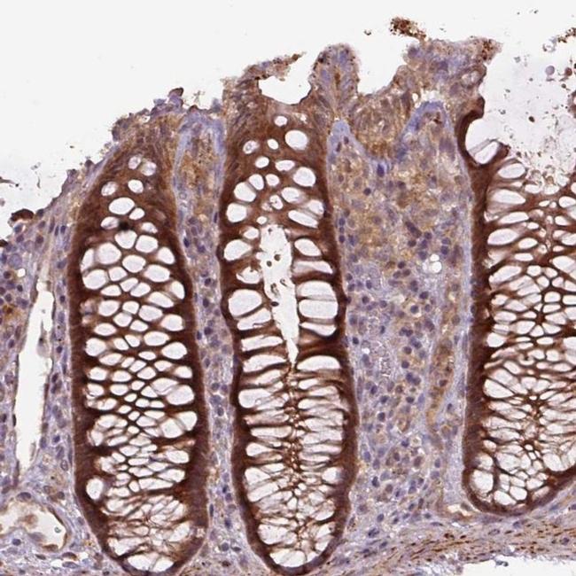 ZSWIM7 Antibody in Immunohistochemistry (IHC)