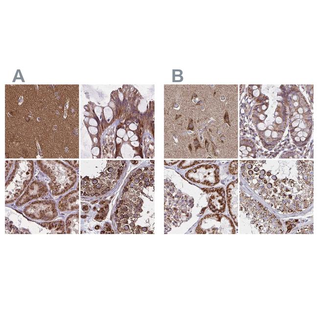 NFS1 Antibody in Immunohistochemistry (IHC)