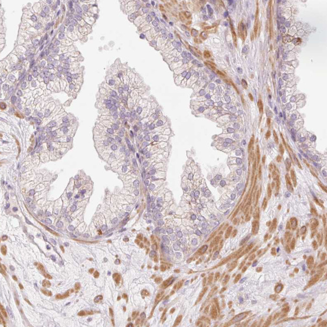 SLC29A3 Antibody in Immunohistochemistry (Paraffin) (IHC (P))