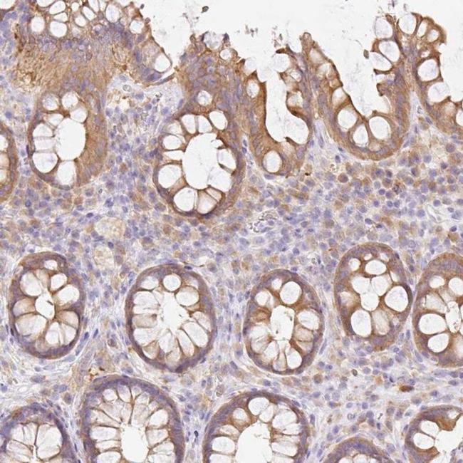 DENND5A Antibody in Immunohistochemistry (IHC)