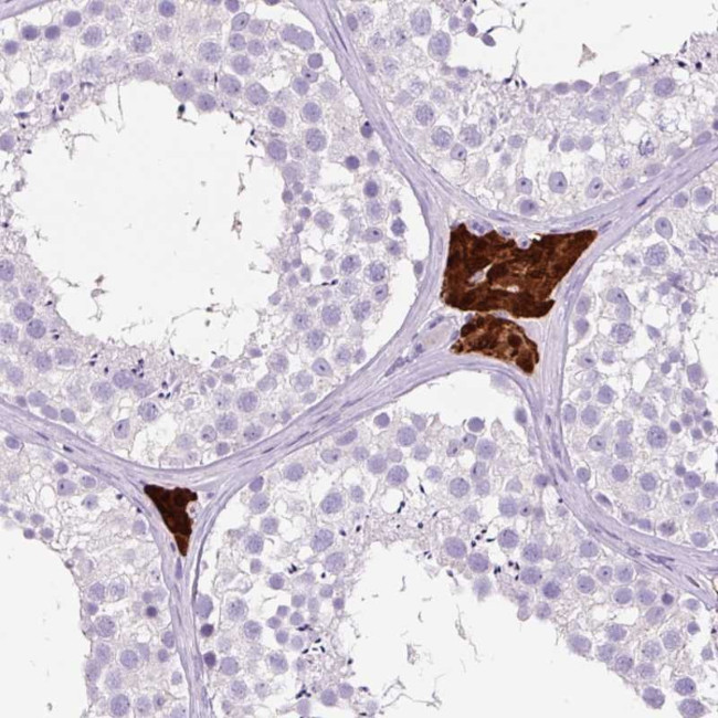 OR10A7 Antibody in Immunohistochemistry (Paraffin) (IHC (P))