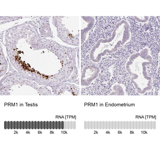 PRM1 Antibody in Immunohistochemistry (IHC)