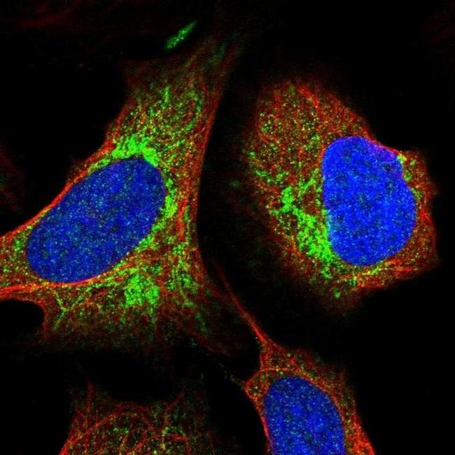 ITPK1 Antibody in Immunocytochemistry (ICC/IF)