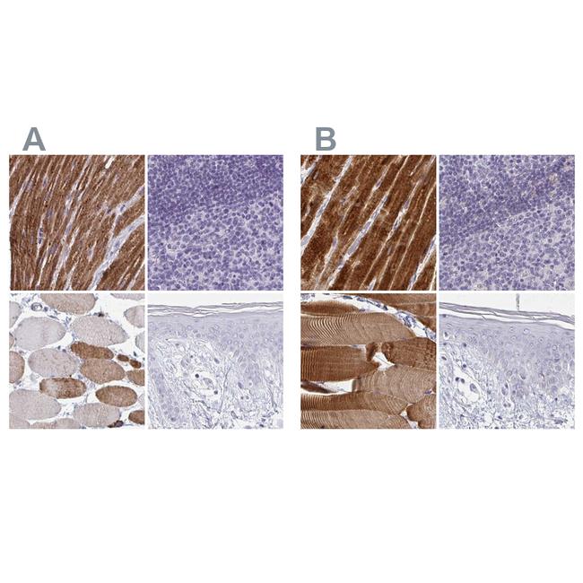 Calsequestrin 2 Antibody in Immunohistochemistry (IHC)