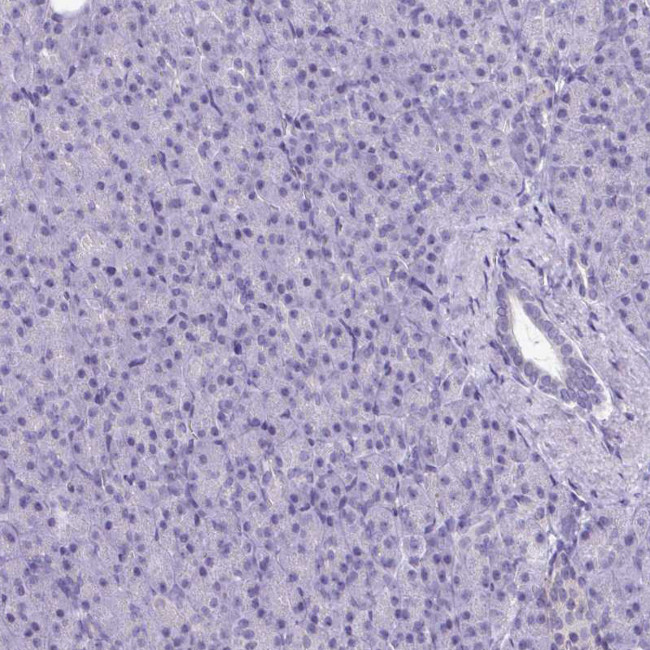 ATP6V0D2 Antibody in Immunohistochemistry (Paraffin) (IHC (P))