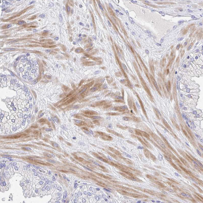 ZNF561 Antibody in Immunohistochemistry (Paraffin) (IHC (P))