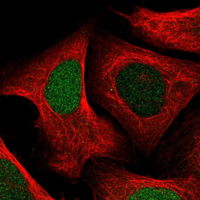 UPP1 Antibody in Immunocytochemistry (ICC/IF)