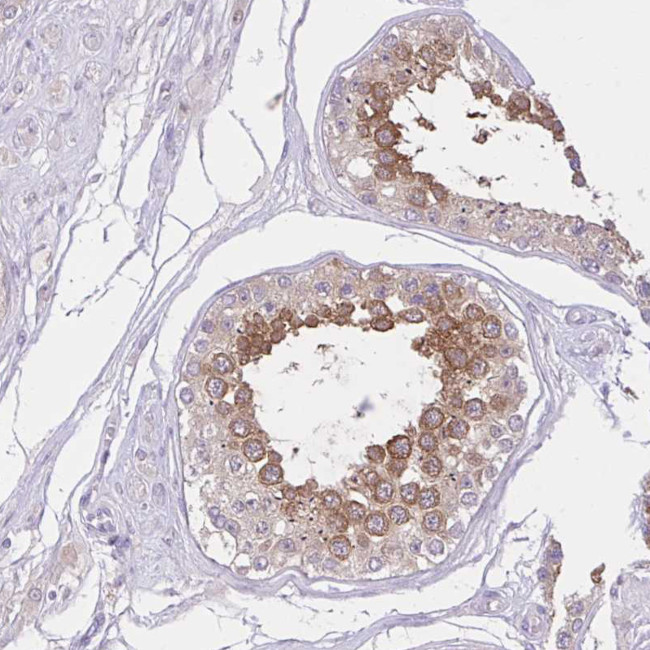 ZNF101 Antibody in Immunohistochemistry (Paraffin) (IHC (P))