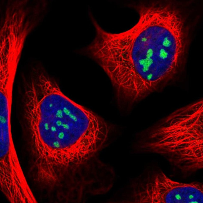 RRS1 Antibody in Immunocytochemistry (ICC/IF)