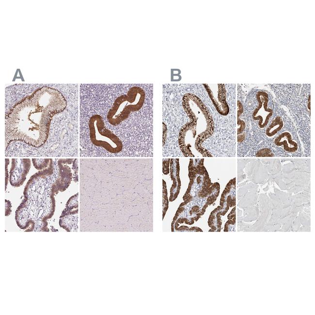 ALP Antibody in Immunohistochemistry (IHC)