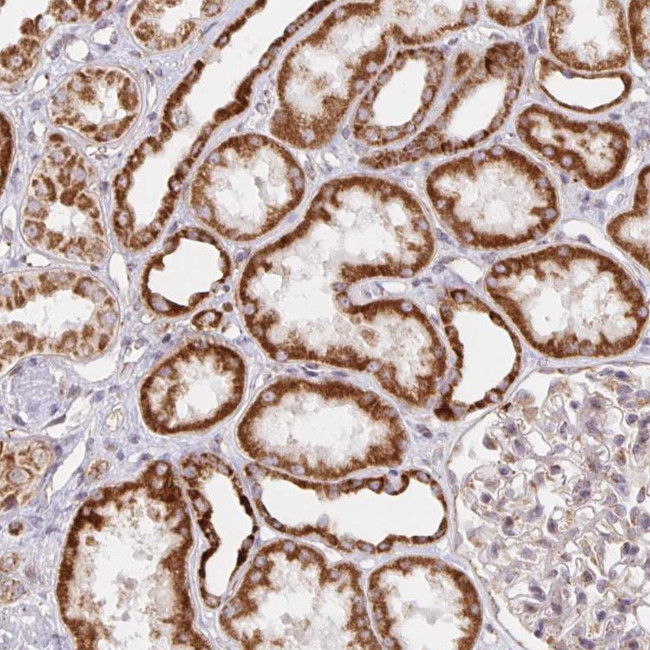 MRPL28 Antibody in Immunohistochemistry (Paraffin) (IHC (P))