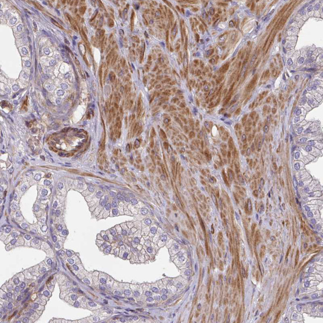 TNMD Antibody in Immunohistochemistry (Paraffin) (IHC (P))