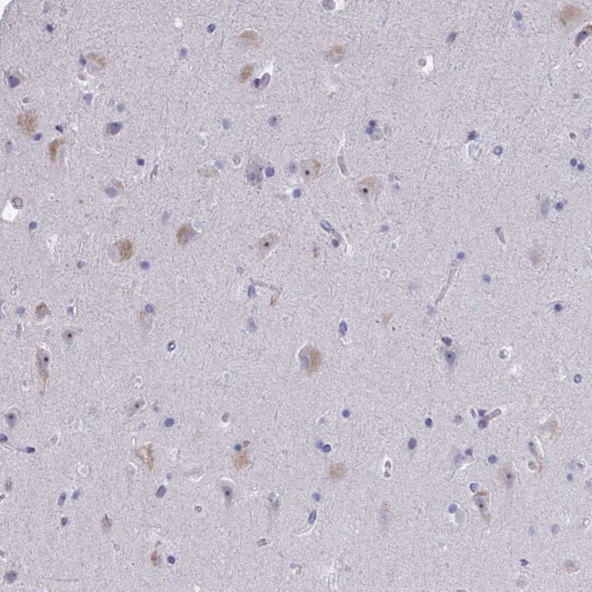 NOXRED1 Antibody in Immunohistochemistry (Paraffin) (IHC (P))