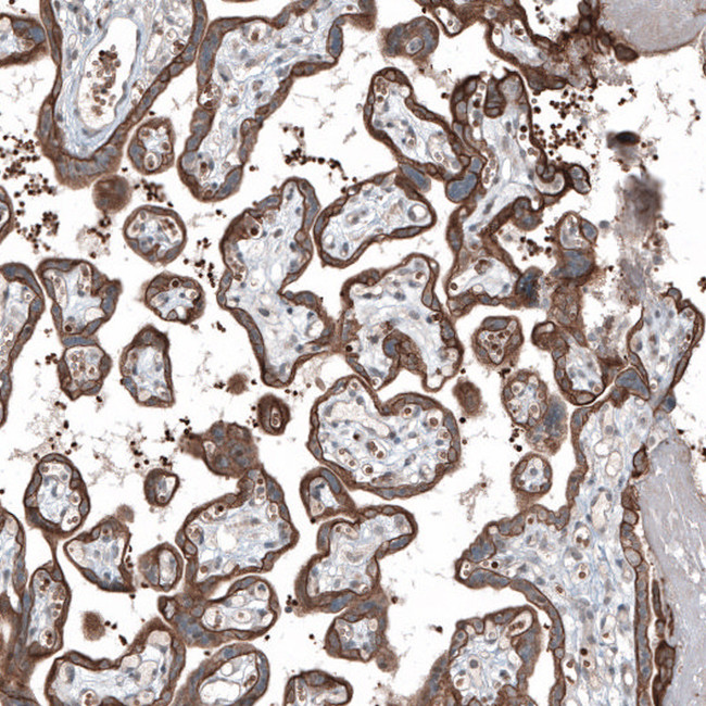 MXRA8 Antibody in Immunohistochemistry (Paraffin) (IHC (P))