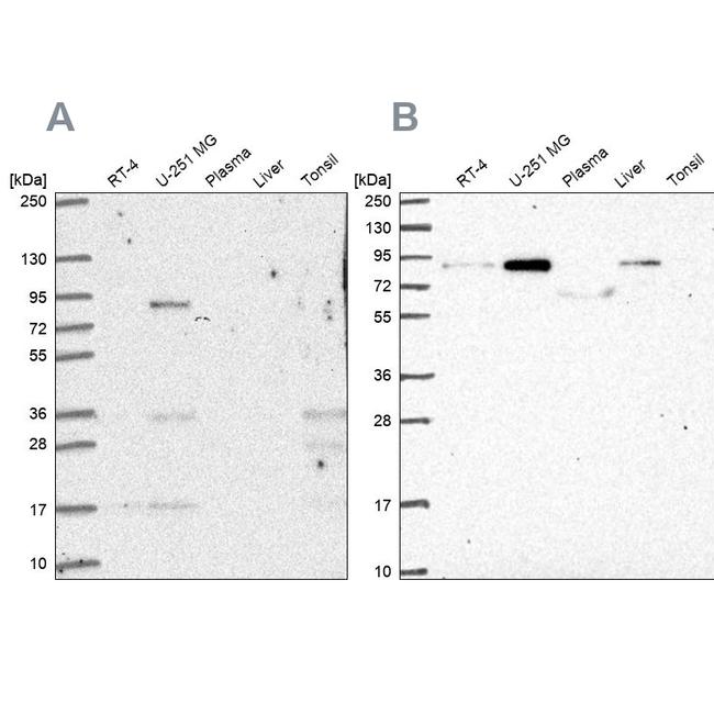 PLOD1 Antibody in Western Blot (WB)