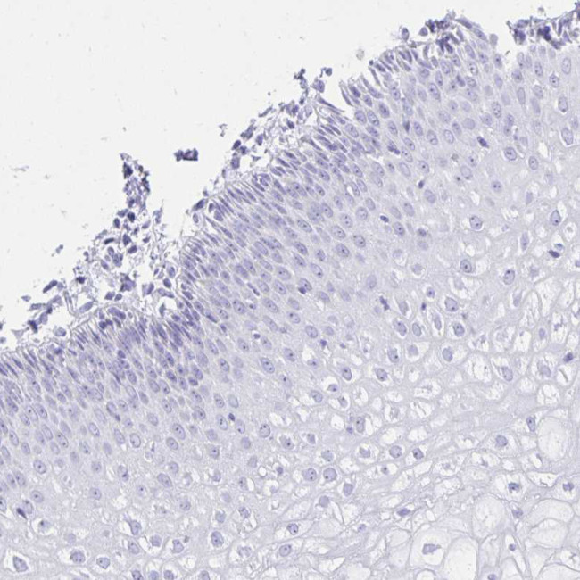 RALYL Antibody in Immunohistochemistry (Paraffin) (IHC (P))