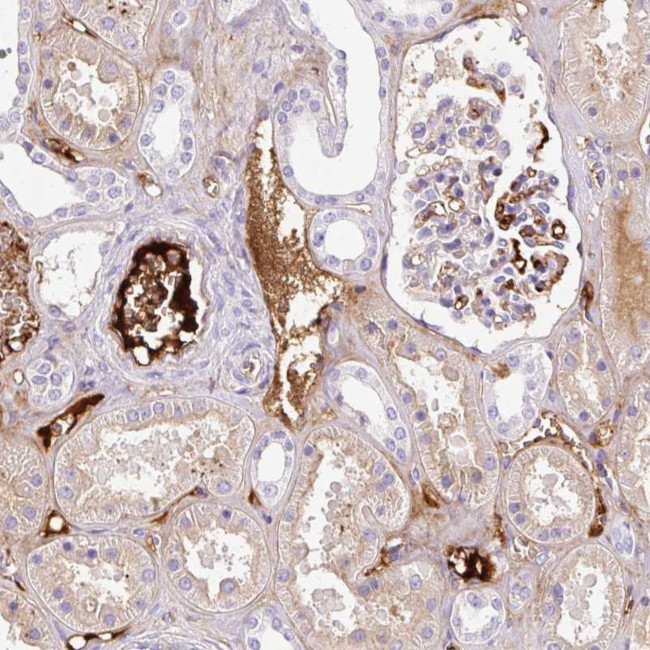 Apolipoprotein C2 Antibody in Immunohistochemistry (Paraffin) (IHC (P))