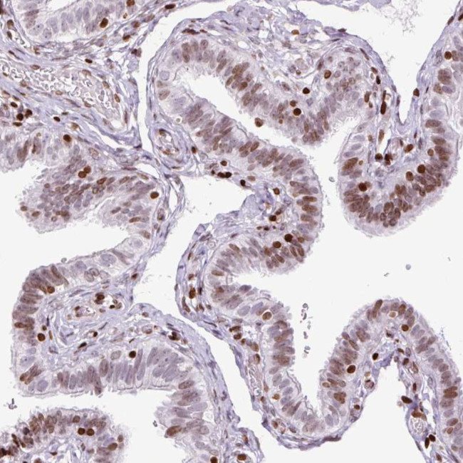 Histone H1.3 Antibody in Immunohistochemistry (Paraffin) (IHC (P))