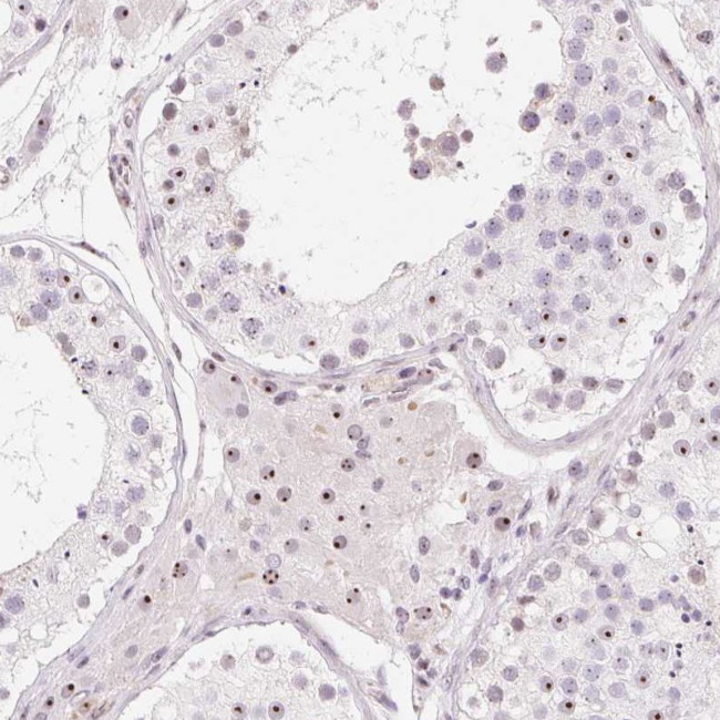 OBP2A Antibody in Immunohistochemistry (Paraffin) (IHC (P))