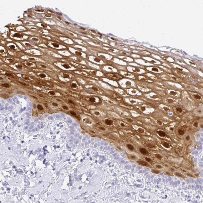 SERPINB3 Antibody in Immunohistochemistry (Paraffin) (IHC (P))