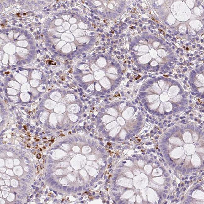 HEXB Antibody in Immunohistochemistry (IHC)