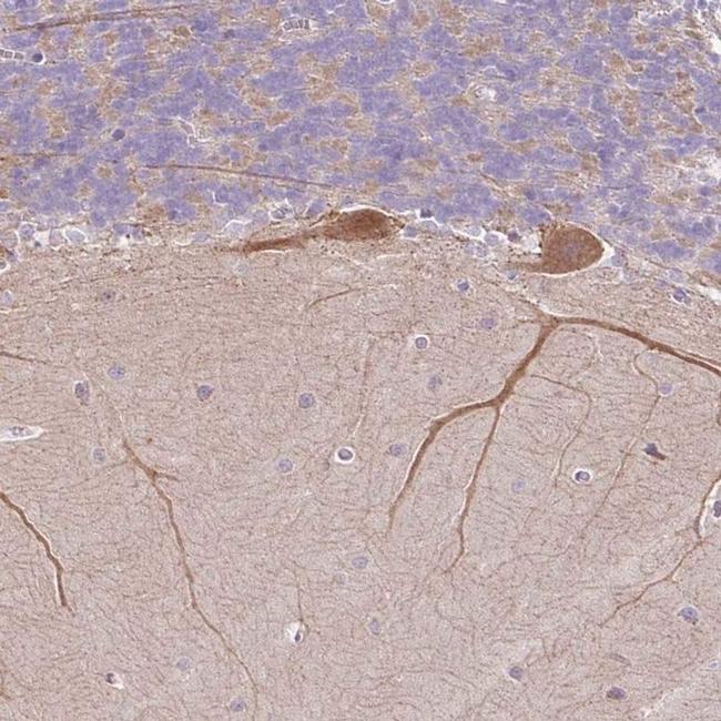 NDST3 Antibody in Immunohistochemistry (IHC)