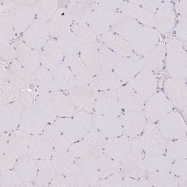 GRID2 Antibody in Immunohistochemistry (Paraffin) (IHC (P))