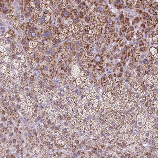 SCO2 Antibody in Immunohistochemistry (IHC)