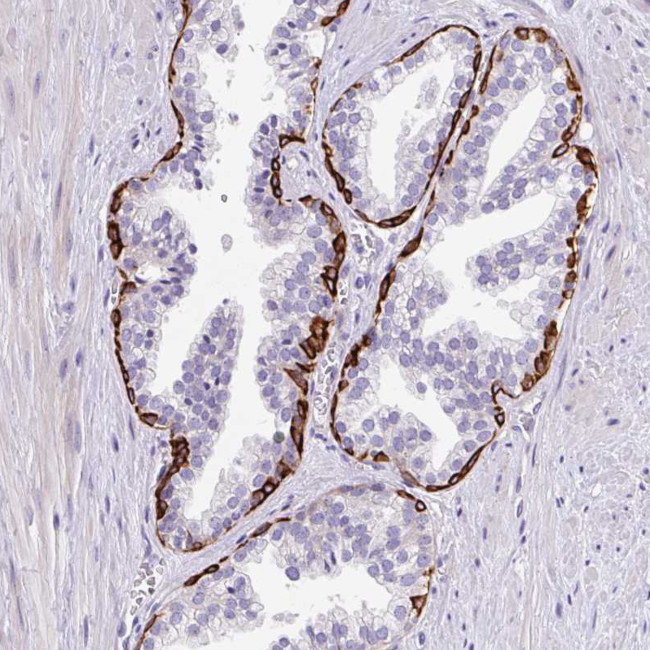 LRRC26 Antibody in Immunohistochemistry (Paraffin) (IHC (P))