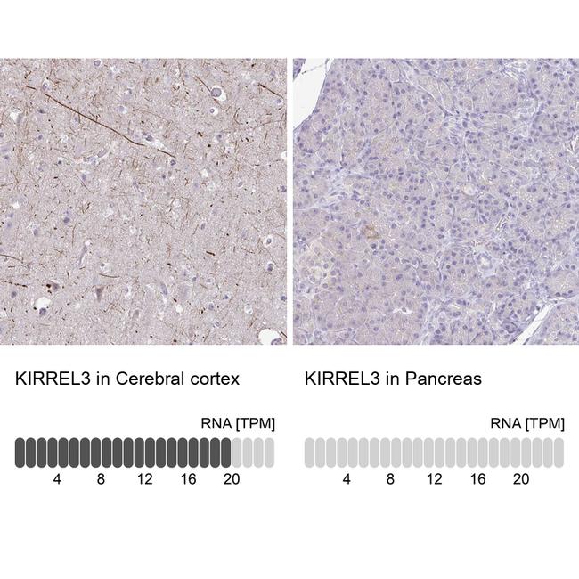 KIRREL3 Antibody in Immunohistochemistry (IHC)