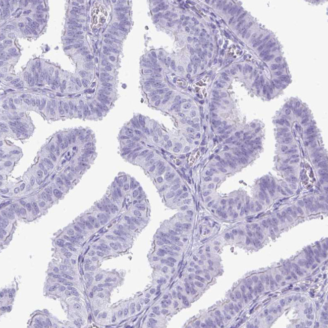 PRM2 Antibody in Immunohistochemistry (Paraffin) (IHC (P))