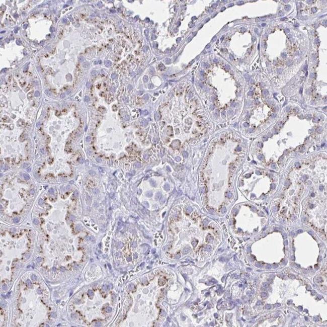 CHMP5 Antibody in Immunohistochemistry (IHC)