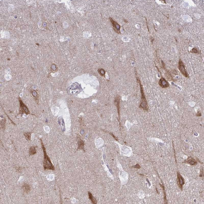 CAMLG Antibody in Immunohistochemistry (Paraffin) (IHC (P))