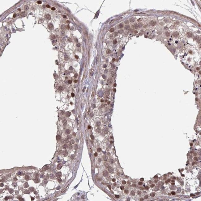 IPO5 Antibody in Immunohistochemistry (IHC)