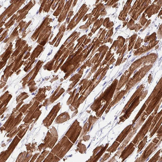 WDR38 Antibody in Immunohistochemistry (Paraffin) (IHC (P))