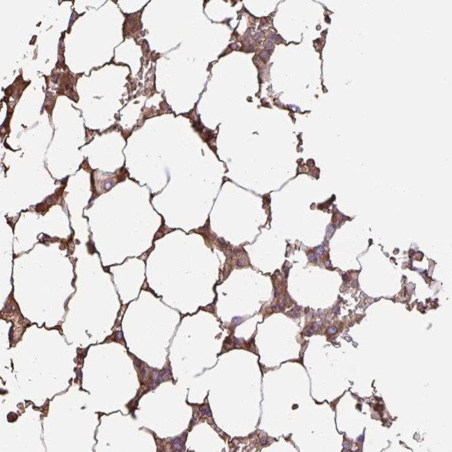 GYLTL1B Antibody in Immunohistochemistry (Paraffin) (IHC (P))