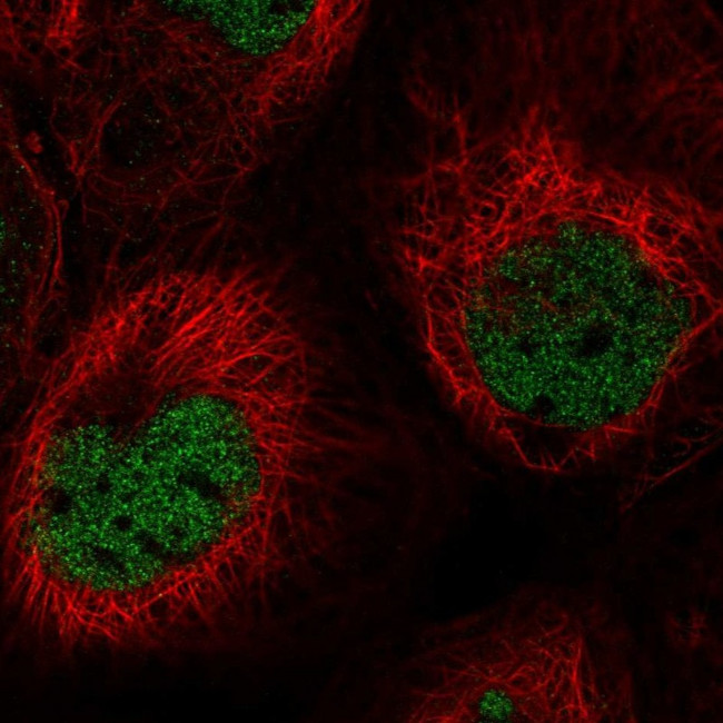 PPP1R10 Antibody in Immunocytochemistry (ICC/IF)