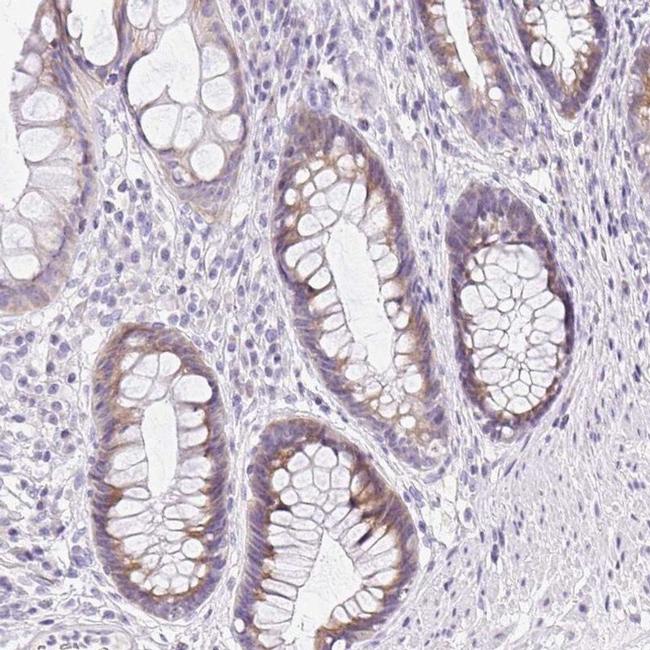 DTX4 Antibody in Immunohistochemistry (IHC)