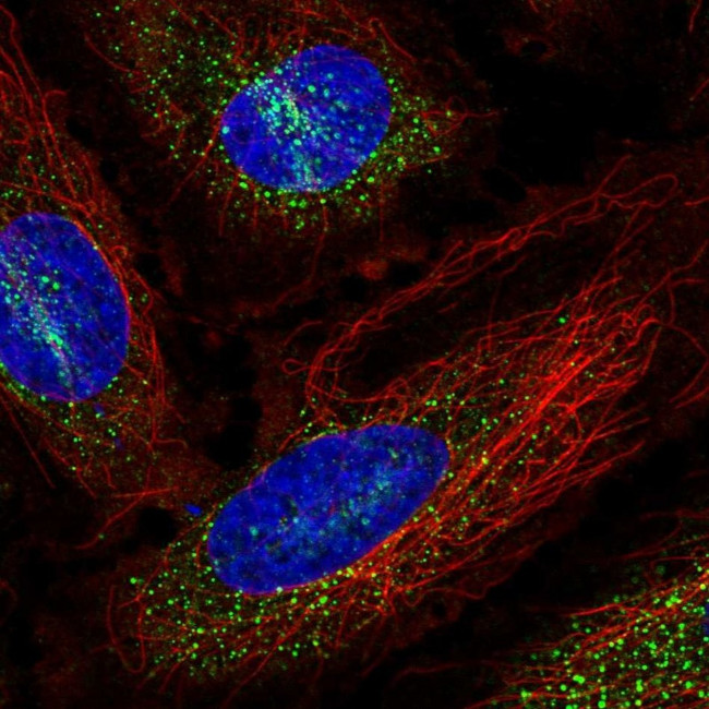 PAIP2 Antibody in Immunocytochemistry (ICC/IF)