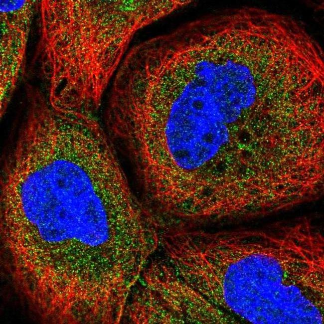 CPTP Antibody in Immunocytochemistry (ICC/IF)