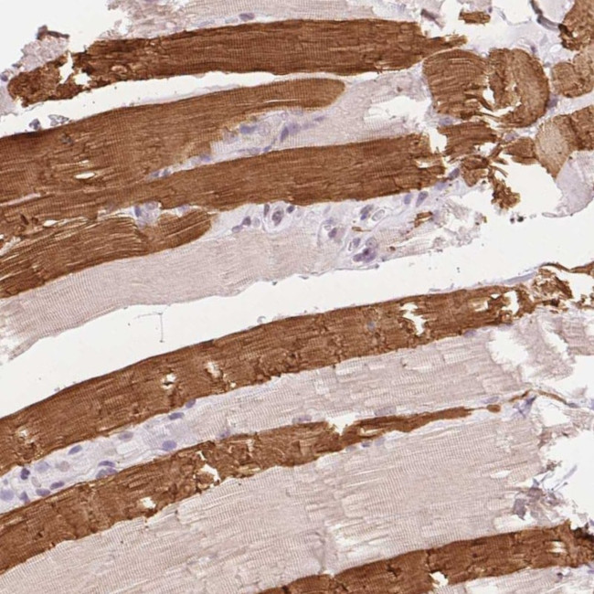 TNNT3 Antibody in Immunohistochemistry (Paraffin) (IHC (P))