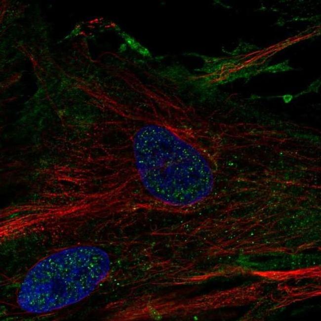 Elastin Antibody in Immunocytochemistry (ICC/IF)