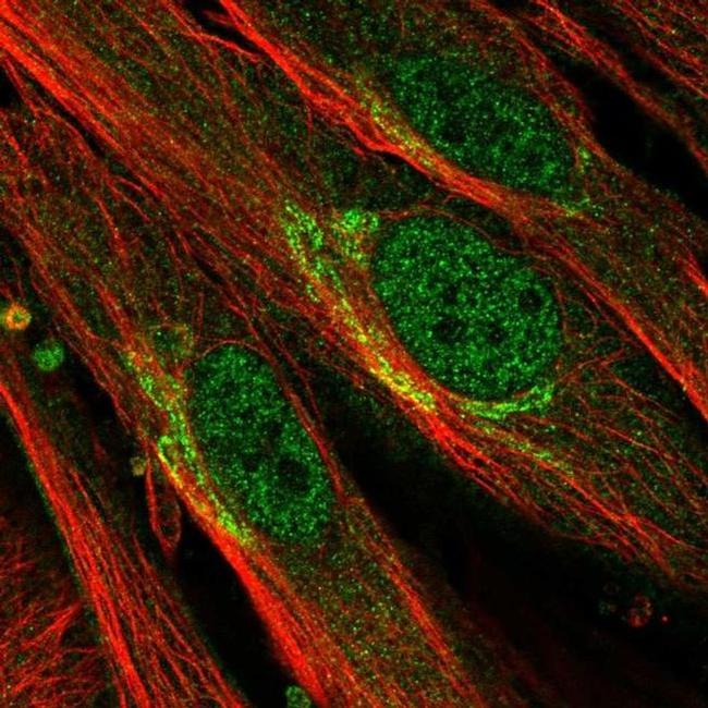 EFHD1 Antibody in Immunocytochemistry (ICC/IF)