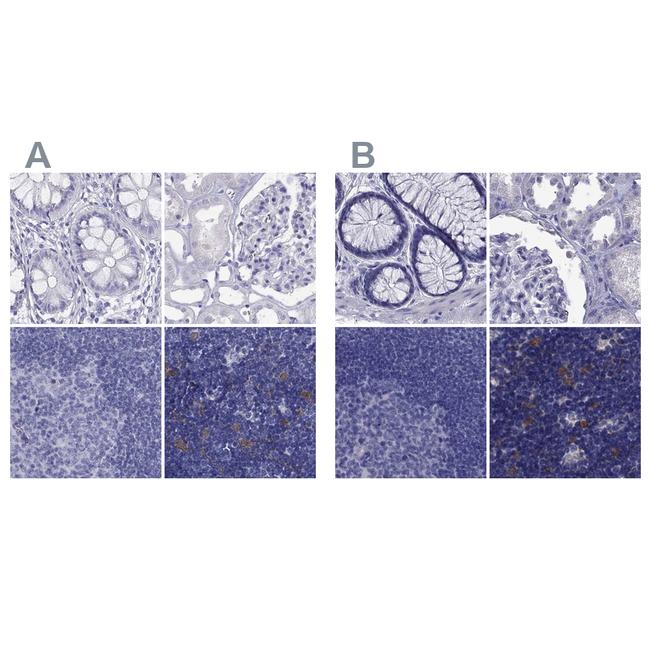 PSMB11 Antibody in Immunohistochemistry (IHC)