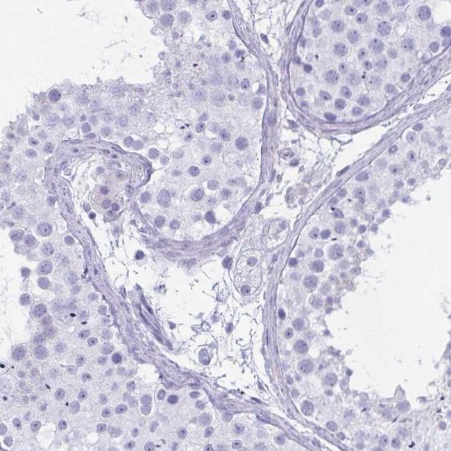 OXLD1 Antibody in Immunohistochemistry (IHC)