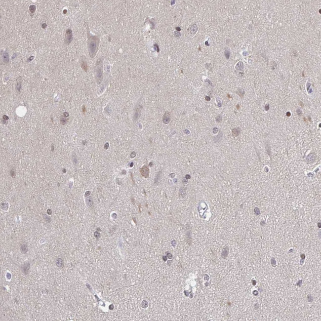 SLC7A10 Antibody in Immunohistochemistry (Paraffin) (IHC (P))