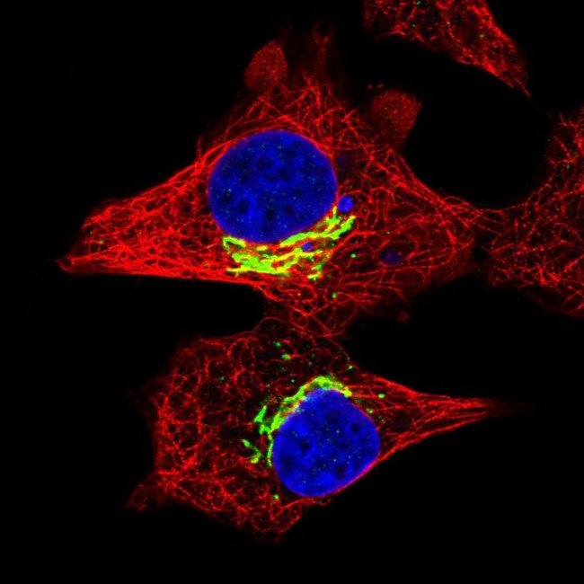 RFK Antibody in Immunocytochemistry (ICC/IF)