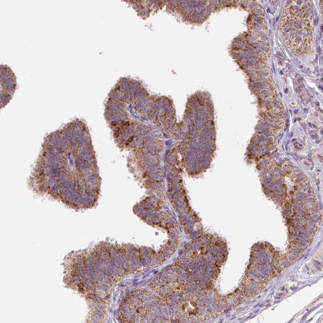 DGUOK Antibody in Immunohistochemistry (Paraffin) (IHC (P))