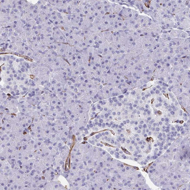 SLC35B1 Antibody in Immunohistochemistry (Paraffin) (IHC (P))