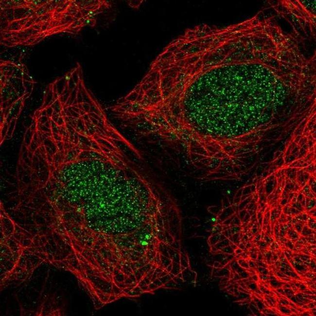 HOXB4 Antibody in Immunocytochemistry (ICC/IF)